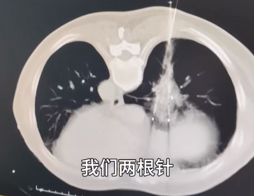 圖片 圖片